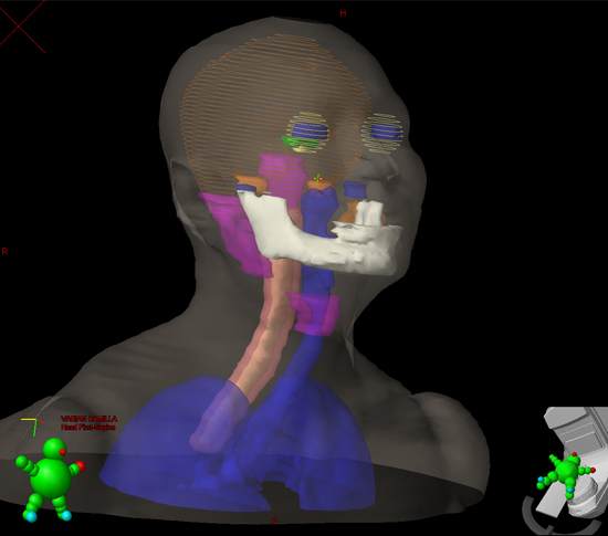 Simulación virtual, una de las técnicas del tratamiento para el cancer